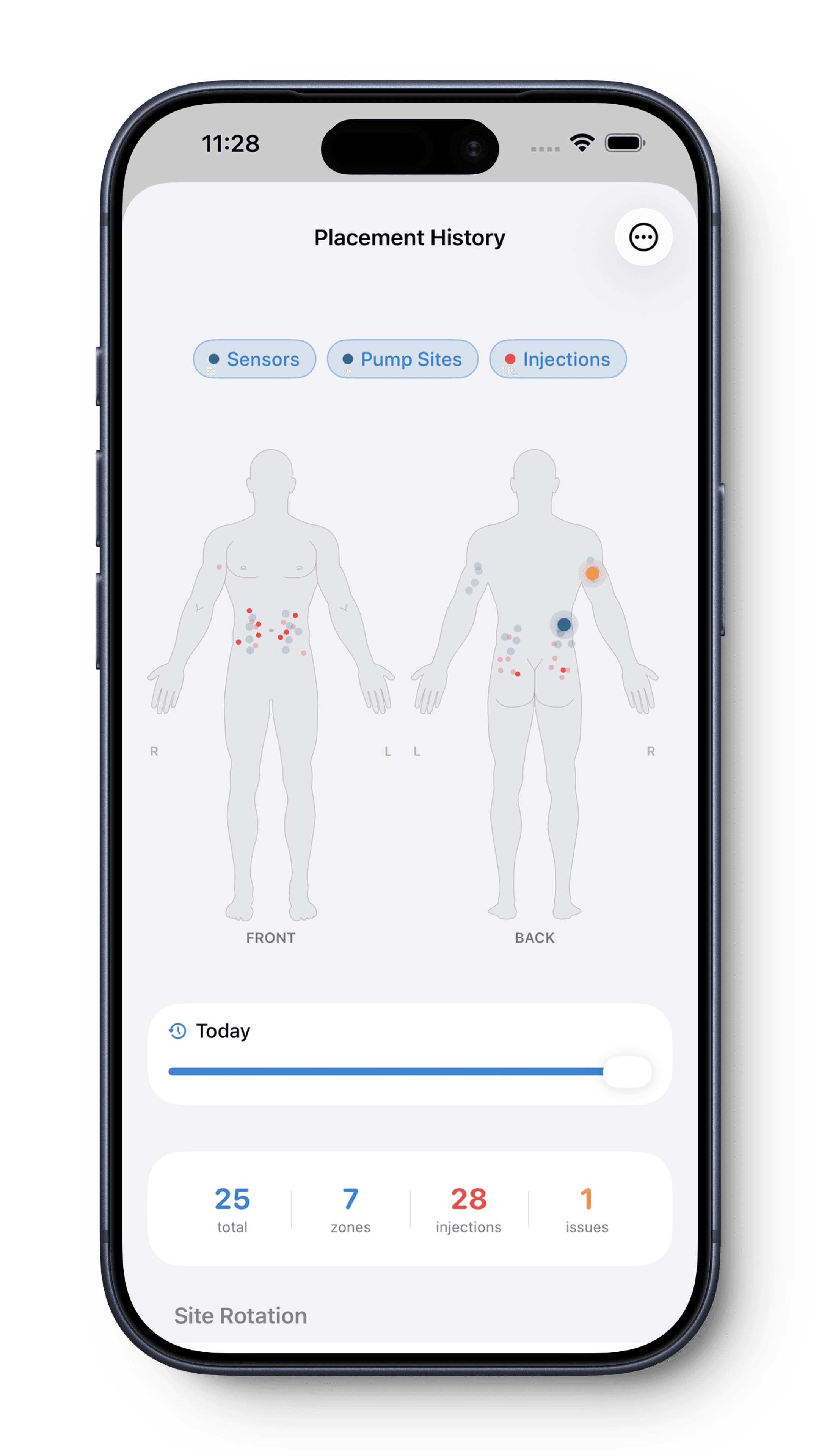 Injection & Site Tracking